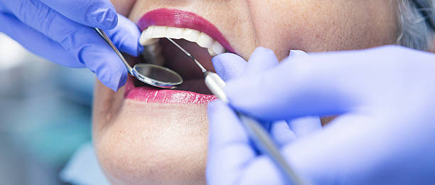 Best Cosmetic Emergency Dentistry in Port Hueneme, CA